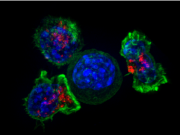 大多数患者在 CAR T 细胞试验中对套细胞淋巴瘤有反应