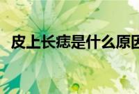 皮上长痣是什么原因（ps材质是食品级吗）