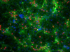 研究人员确定帕金森氏症蛋白质何时对脑细胞产生性