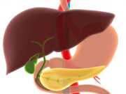 抗氧化剂普瑞巴林可减轻慢性钙化性胰腺炎的疼痛