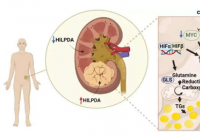 HILPDA 蛋白：侵袭性肾癌新治疗方案的潜在生物标志物