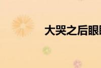 大哭之后眼睛会肿蚂蚁庄园